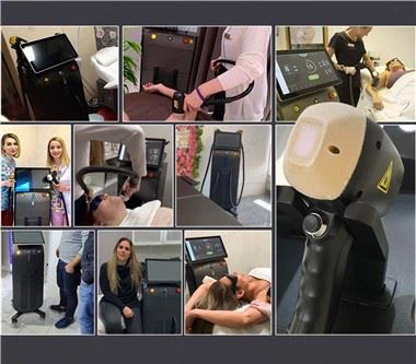 Perangkat Penghilang Bulu Laser Terbaik Soprano Titanium