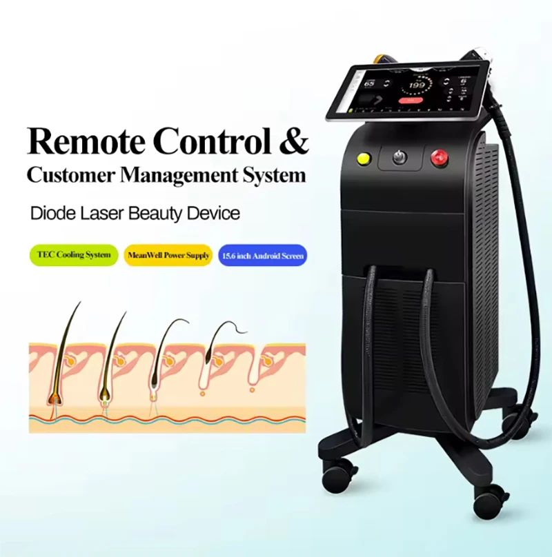 Sistem Penghilang Rambut-Laser Dioda Kelas Medis