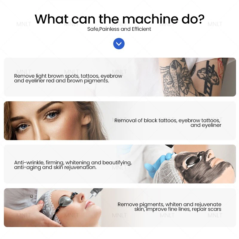 ND YAG Laser Machine – Professional Solution For Tattoo Removal & Skin Treatments suppliers