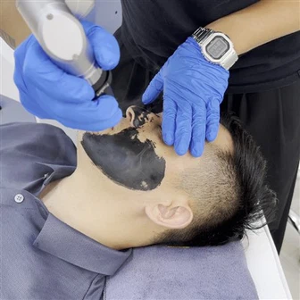 Mesin Laser Picosecond Terbaik