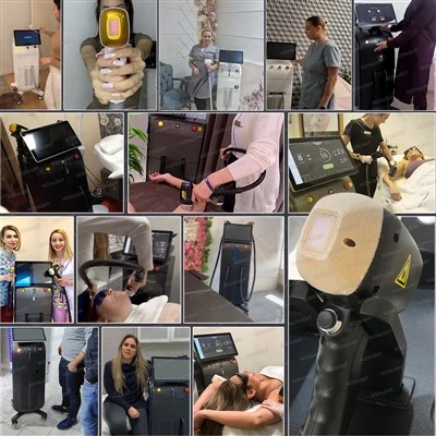 Mesin Penghilang Bulu Laser Berperingkat Tinggi