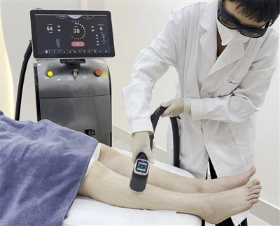 Top 5 Mesin Penghilang Rambut Laser Profesional