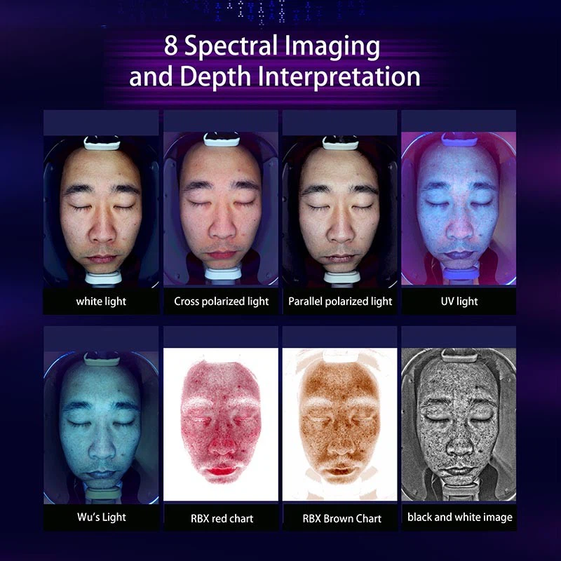 X3Pro AI Skin Analyzer: The Future Of Skin Care Diagnostics factory